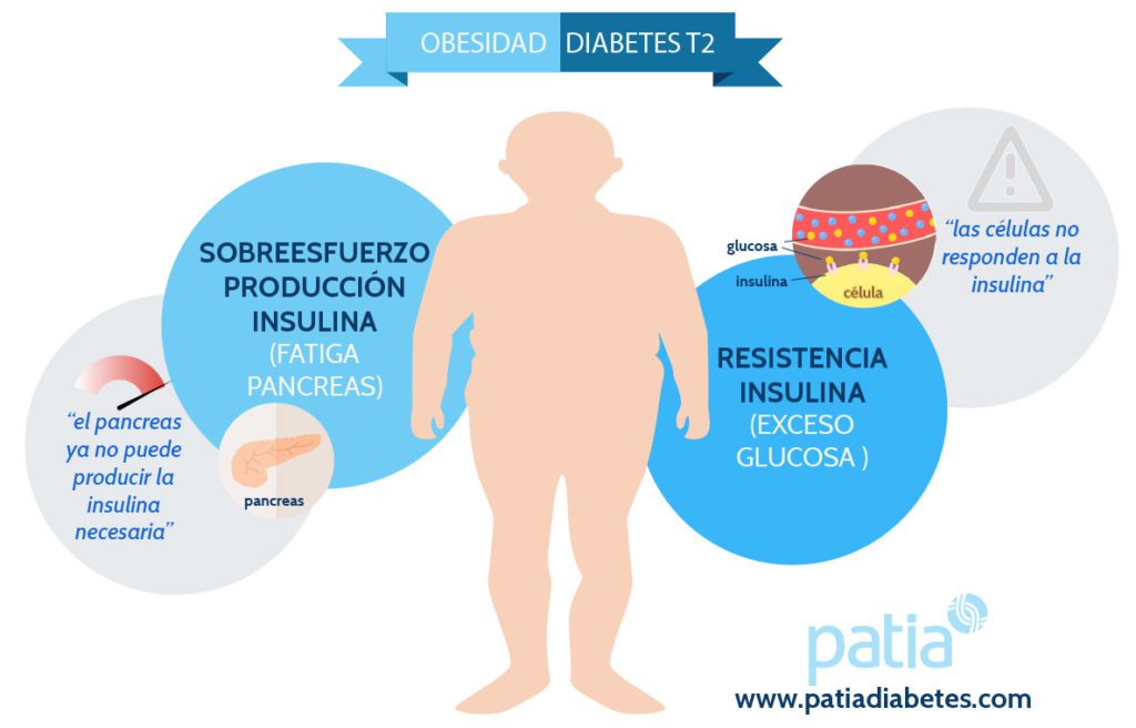¿por Qué La Obesidad Produce Diabetes Tipo 2 ¿cómo Prevenirlas Patia Diabetesemk 9141
